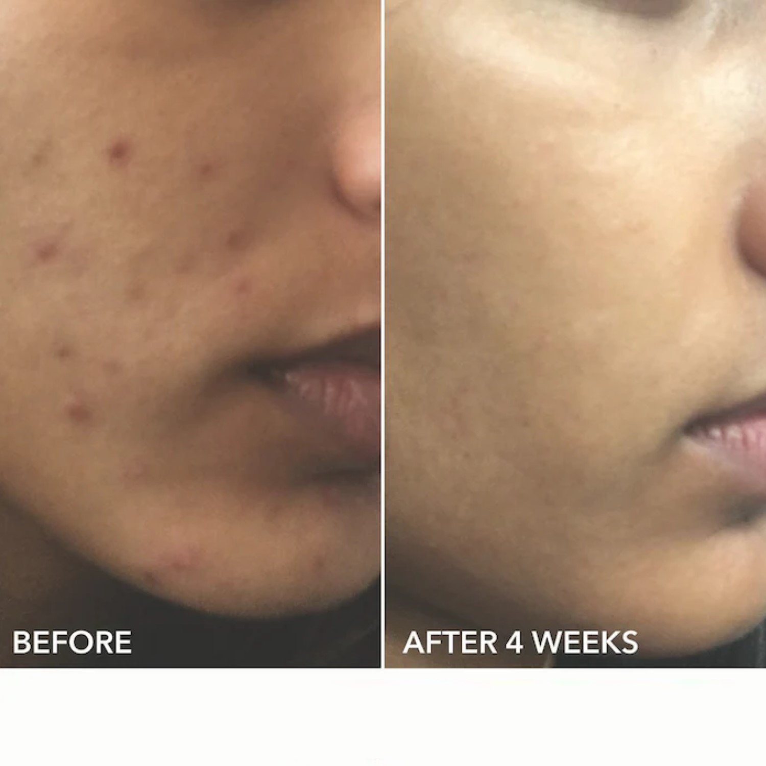ALPHA BETA EXTRA STRENGTH DAILY PEEL  (ALMOHADILLAS EXFOLIANTES DIARIAS EXTRAFUERTES)